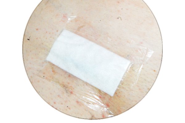 Водостойкая септичная повязка на ране. Сравнить: бактерицидный лейкопластырь для ран.